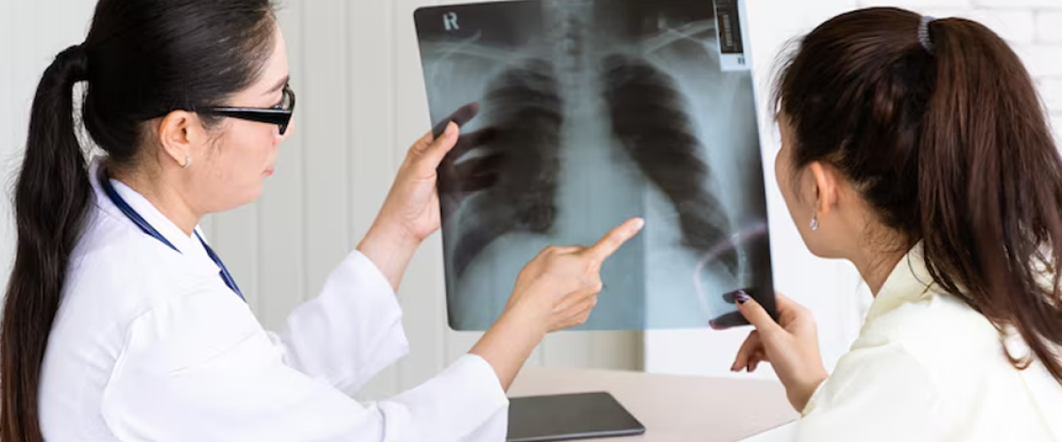 Tuberculosis Treatment