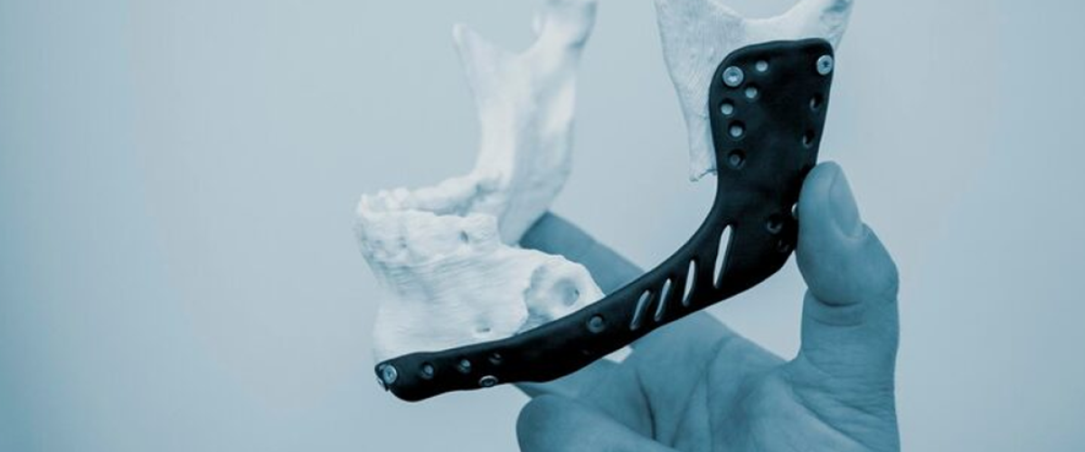 Lumber Fracture surgery and implant