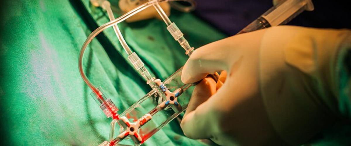 Arterial Switch Operation (ASO)