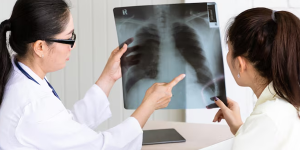 Tuberculosis Treatment