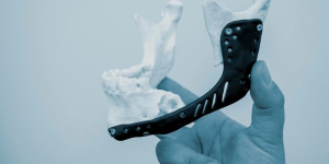 Lumber Fracture surgery and implant