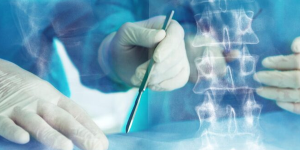 Spinal Cord Tumor Excision Surgery